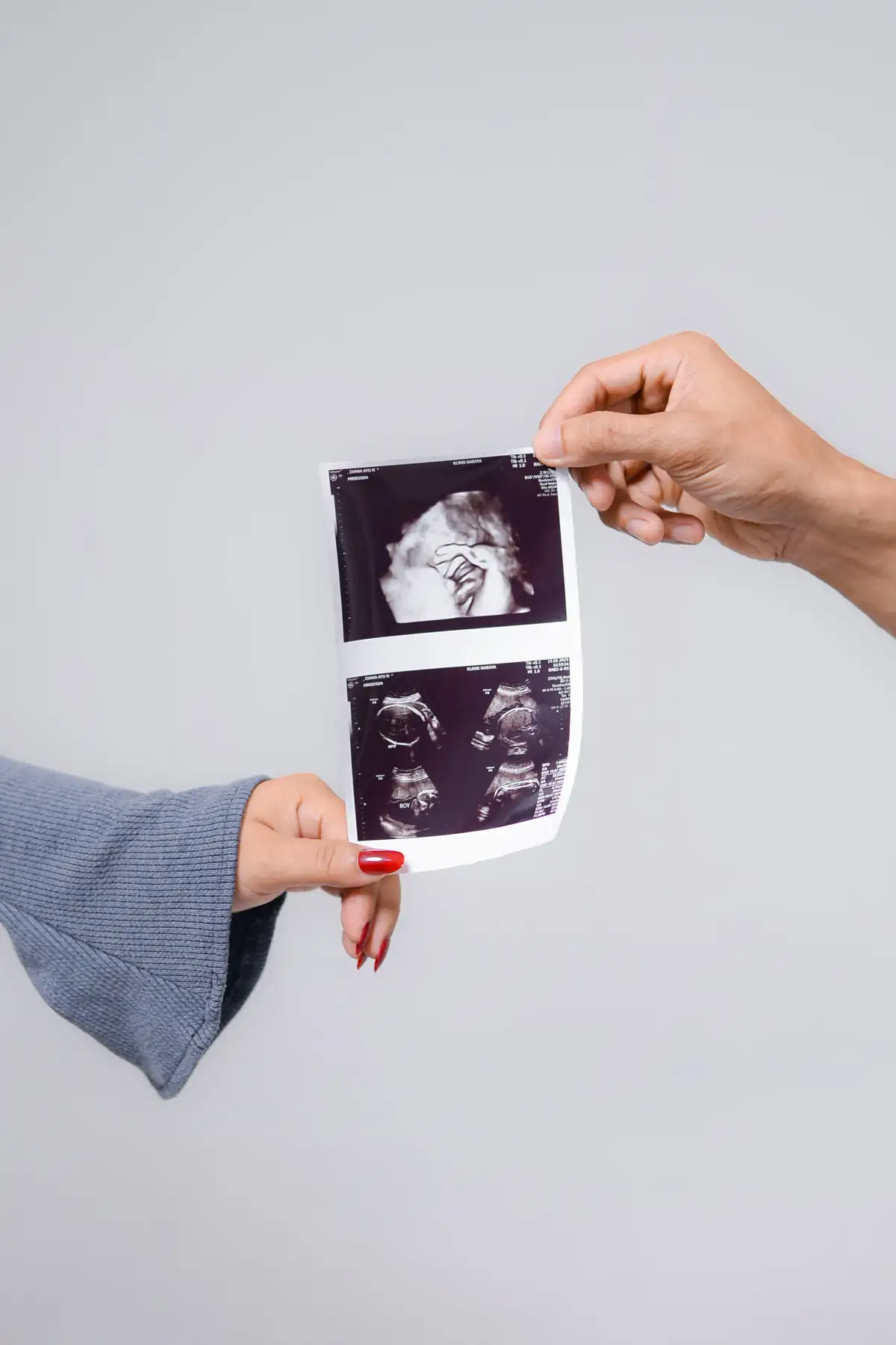 The Maternity